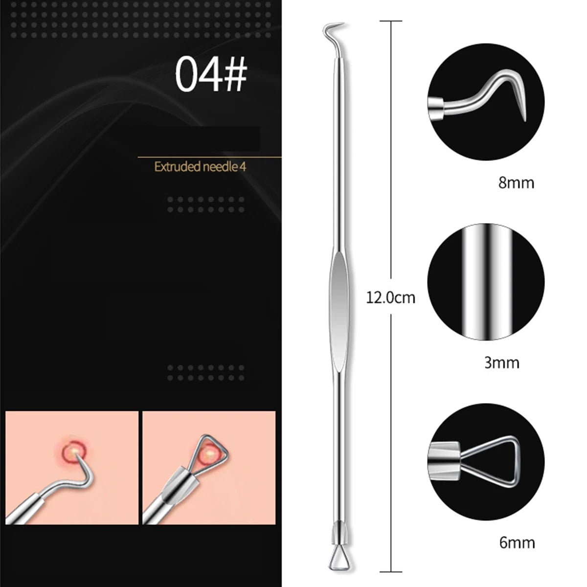 Acne Blackhead Remover Needle Hook