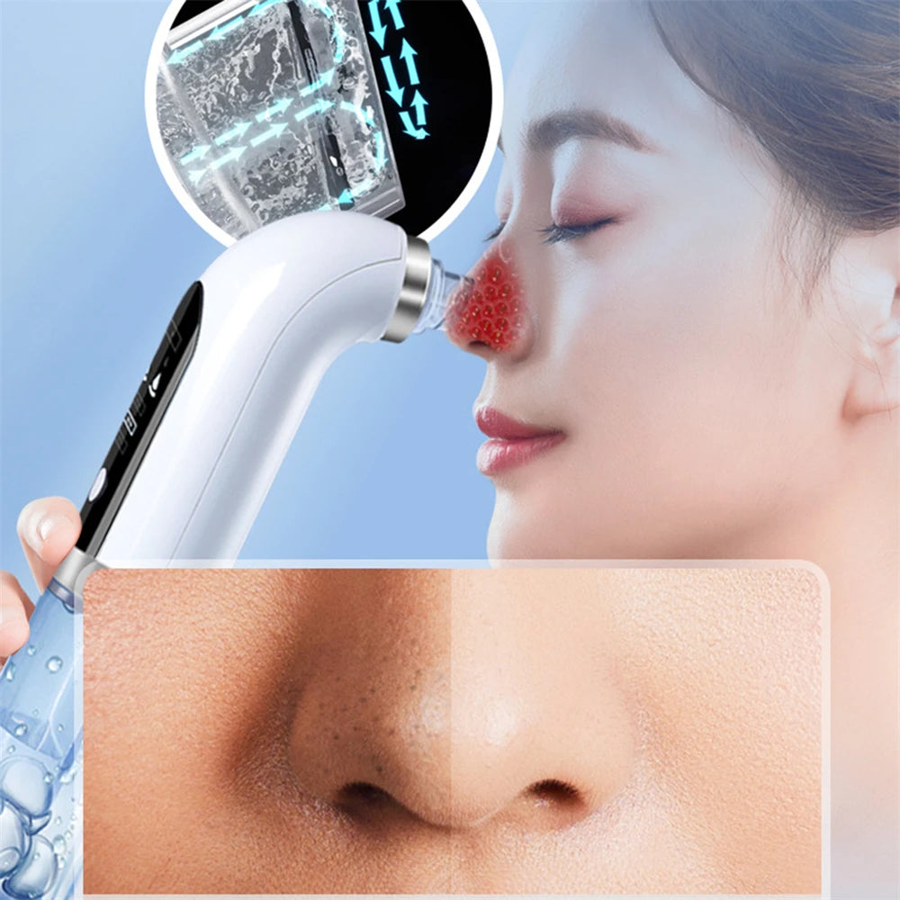 Electric Blackhead Vacuum Cleaner