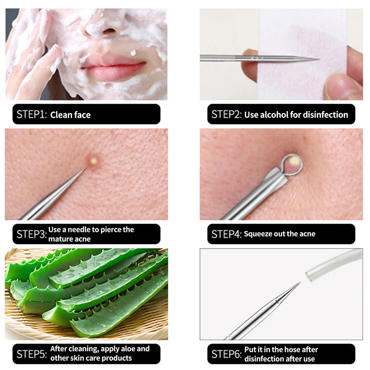 Acne Blackhead Remover Needle Hook