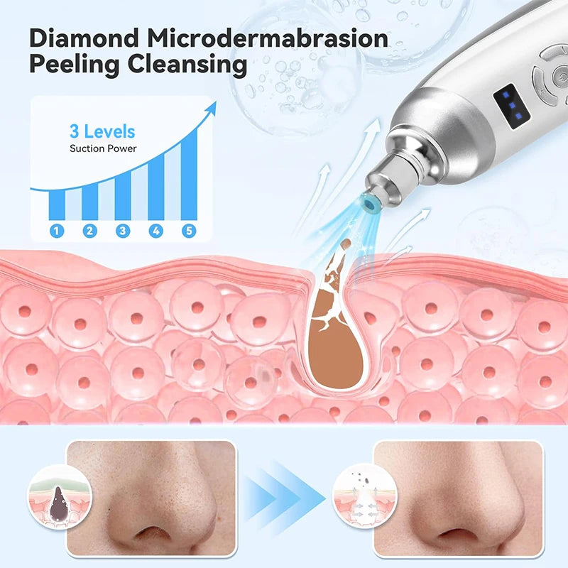 Blackhead Removal Facial Beauty Device